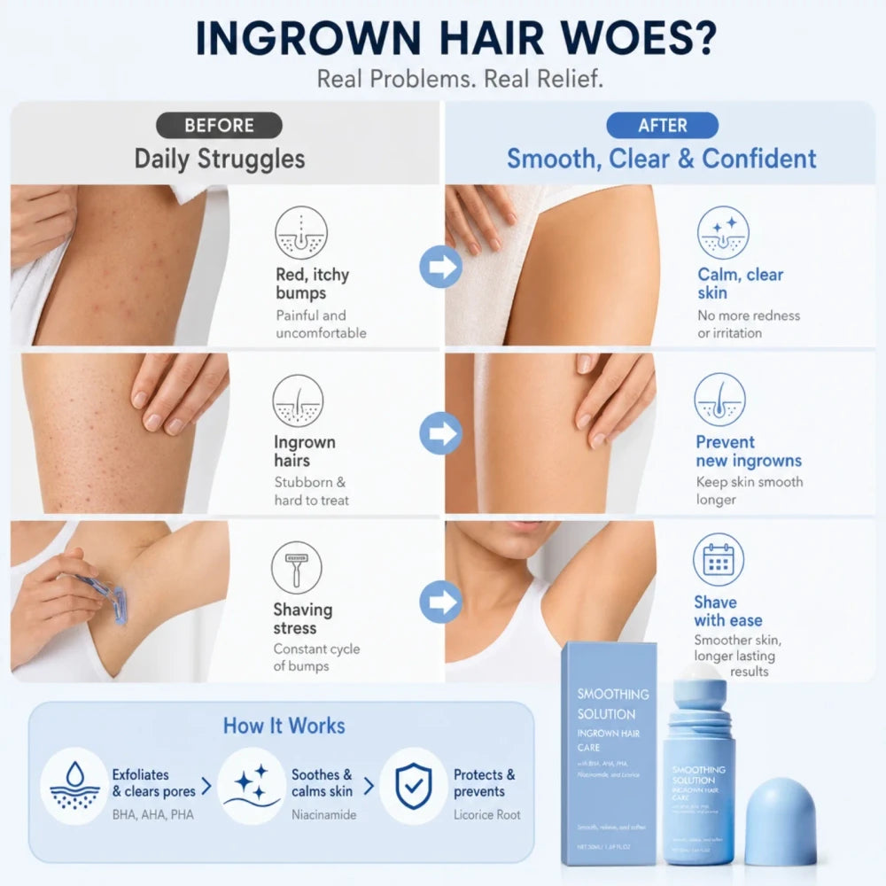 Ingrown Hair Smoothing Roll-On Solution