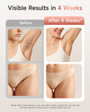 At-Home IPL Hair Removal Device