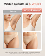 At-Home IPL Hair Removal Device