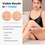 Ice Cooling IPL Hair Removal Device